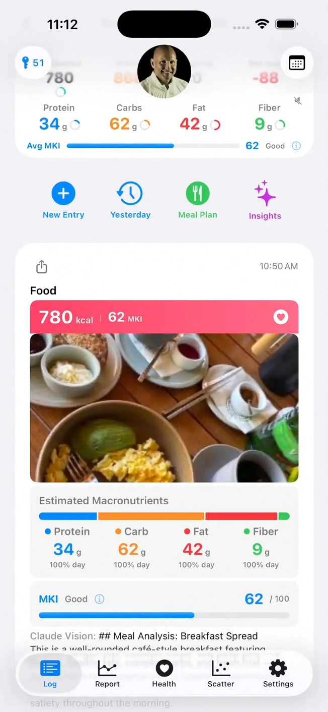 Food Health app home screen showing macros, AI meal photo analysis, and MKI score