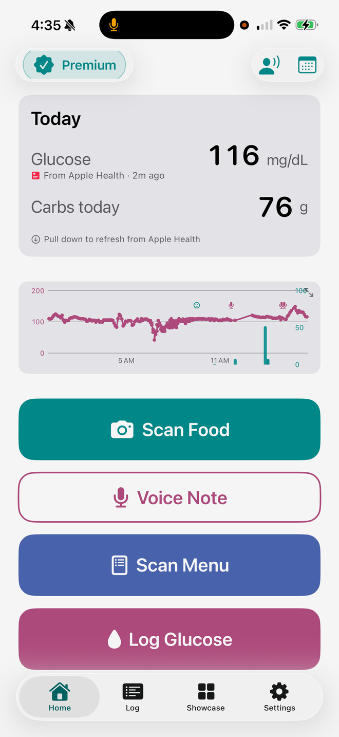 Food Health TxD home screen: today's glucose 116 mg/dL from Apple Health, 76 g carbs, a mini trend chart, and the Scan Food, Voice Note, Scan Menu and Log Glucose buttons